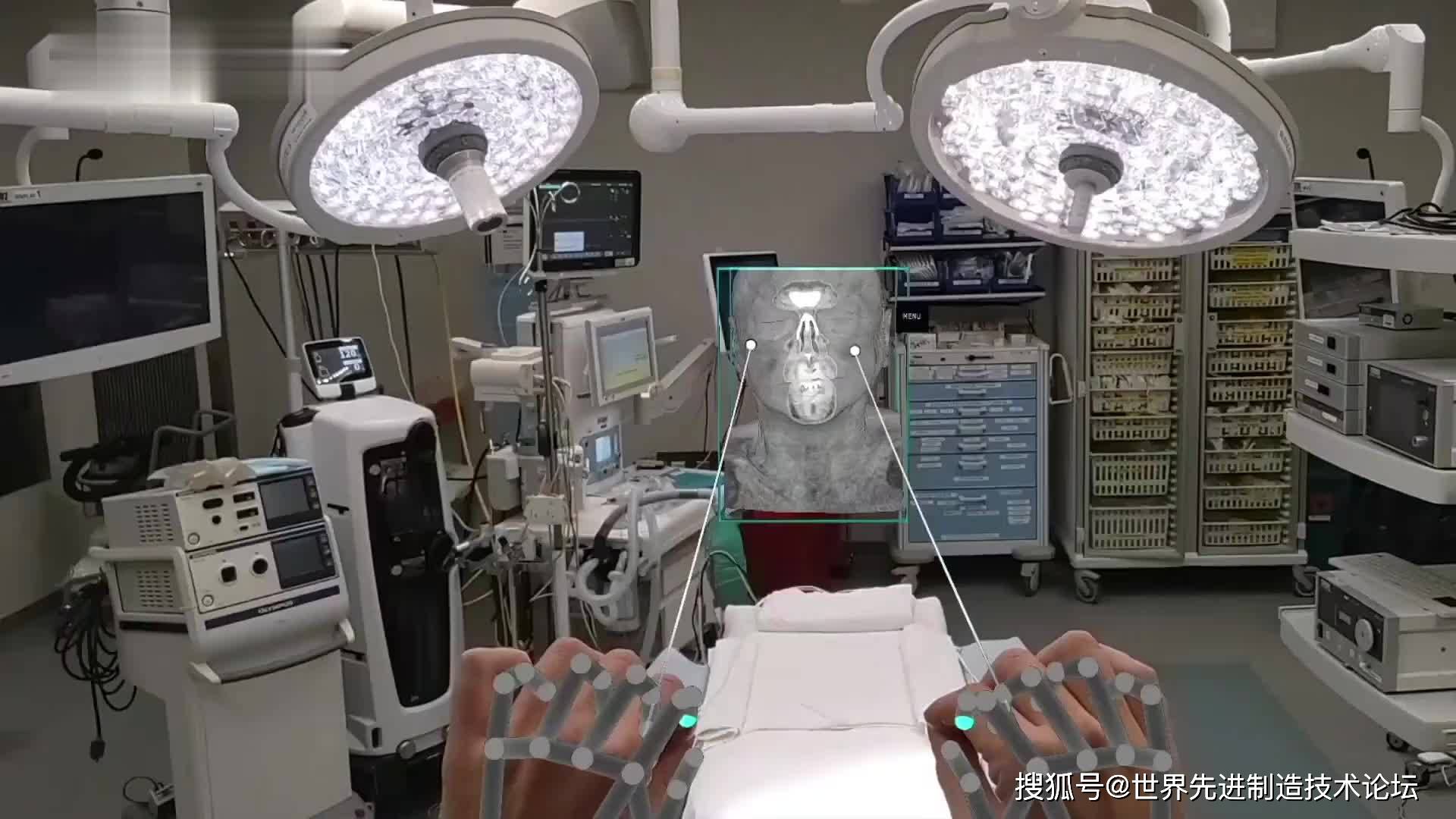 人工智能在医疗行业的革命性突破